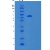 人Syntaphilin (SNPH)重组蛋白