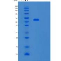 人Syntaphilin (SNPH)重组蛋白