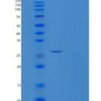人胸腺细胞核蛋白1(THYN1)重组蛋白