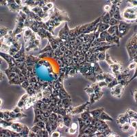 NCI-H2087人非小细胞肺腺癌细胞