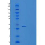 人组织金属蛋白酶抑制因子4(TIMP4)重组蛋白