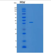 人转录延伸因子A2(TCEA2)重组蛋白