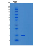 人α-突触核蛋白A53T重组蛋白