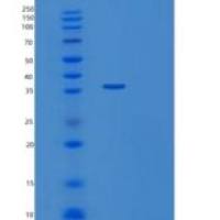 人磺基转移酶1C2 (SULT1C2)重组蛋白