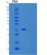 人含Toll白介素1受体域衔接蛋白(TIRAP)重组蛋白
