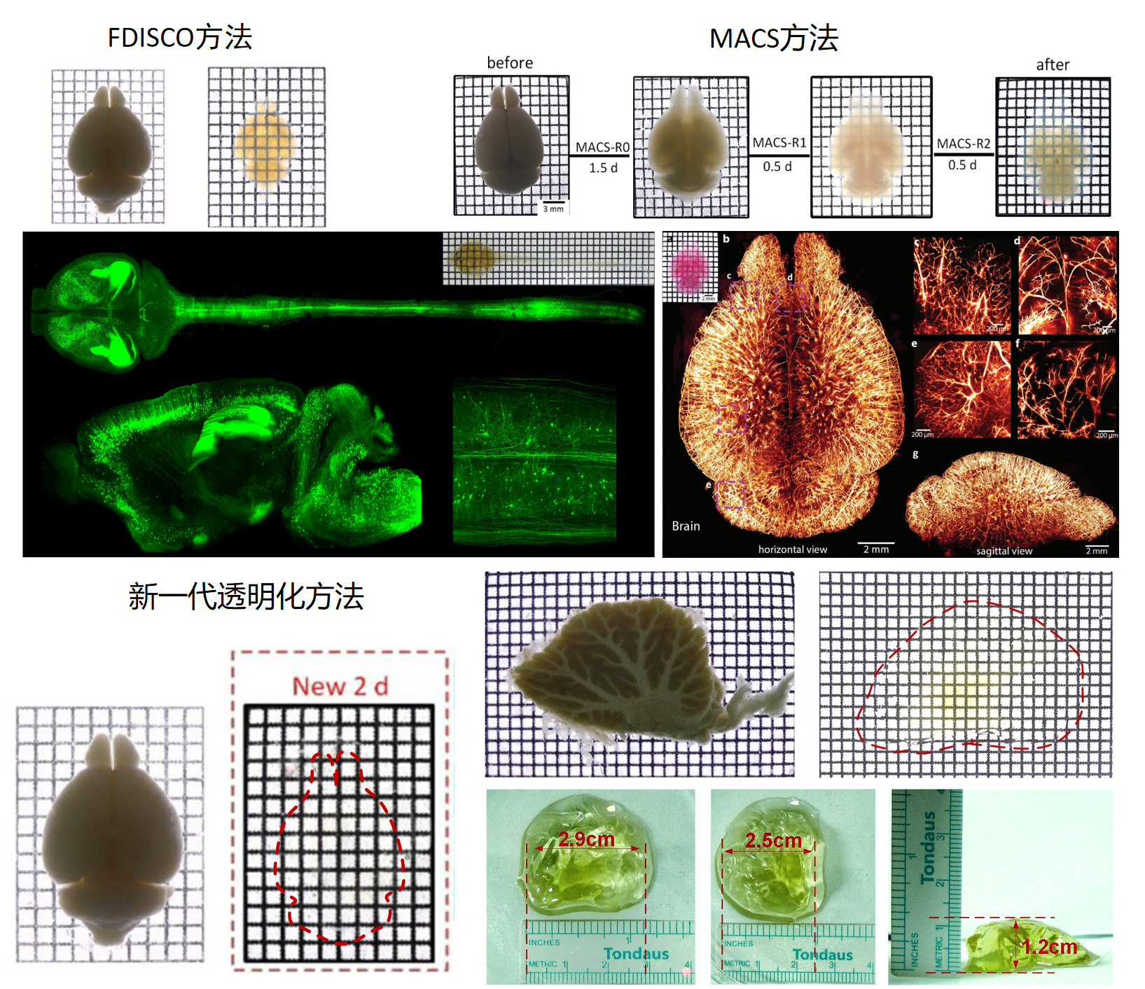 《Bioconjugate Chemistry》：组织透明化三维成像揭示小分子外用药物NA在脑内分布