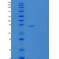 人THG1L重组蛋白