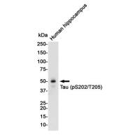 Anti-Tau (phospho S202 + T205)