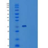 人含Toll白介素1受体域衔接蛋白(TIRAP)重组蛋白