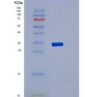 人突触囊泡蛋白Ⅰ(SYT1)重组蛋白