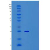 人前mRNA剪接因子SYF2(SYF2)重组蛋白