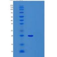人前mRNA剪接因子SYF2(SYF2)重组蛋白
