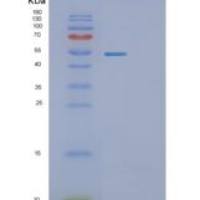 大肠杆菌tnaa重组蛋白