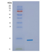 人α-突触核蛋白重组蛋白