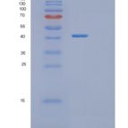 人原肌球调节蛋白3(TMOD3)重组蛋白
