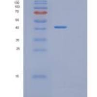 人原肌球调节蛋白3(TMOD3)重组蛋白