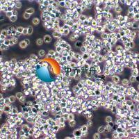 RI-1 人B细胞淋巴瘤