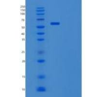 小鼠酪氨酸羟化酶(TH)重组蛋白