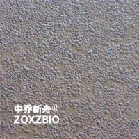 SNU-668人胃癌细胞