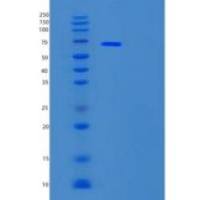 人T复合体蛋白1(TCP1)重组蛋白