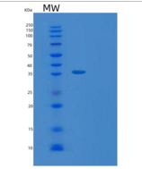 人TATDN1重组蛋白
