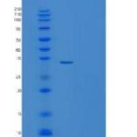人TATDN3重组蛋白