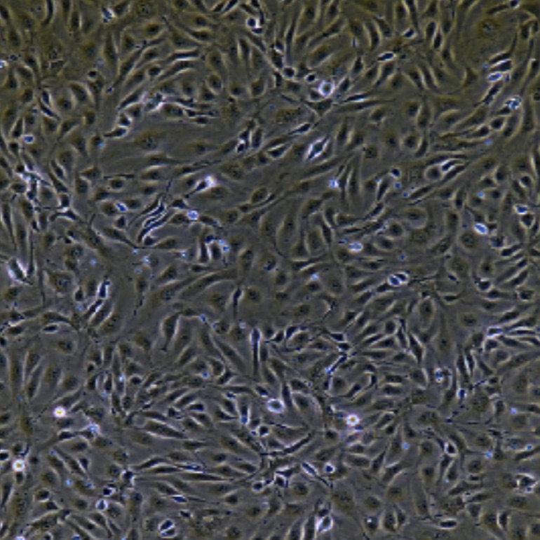 人原代脐静脉内皮细胞 Umbilical Vein Endothelial Cells