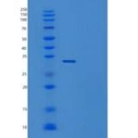 人TP53诱导糖酵解凋亡调节蛋白(TIGAR)重组蛋白