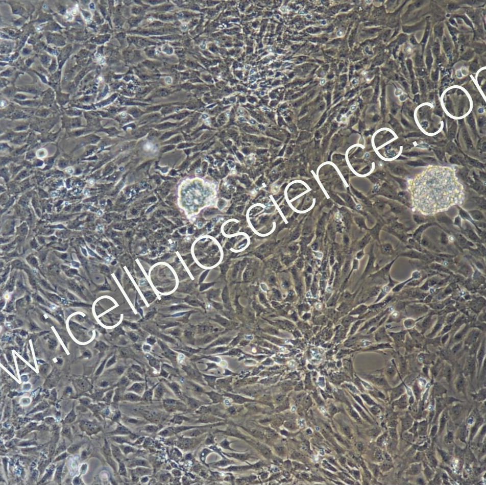 大鼠脐静脉内皮细胞/免疫荧光鉴定/镜像绮点（Cellverse）