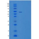 人TNFRSF11A重组蛋白