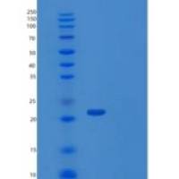人肿瘤坏死因子相关配体分子1A(TL1A)重组蛋白