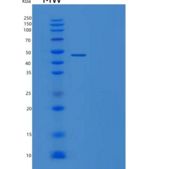 人TNFRSF1A关联Via死亡域蛋白(TRADD)重组蛋白