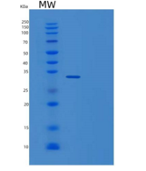 人TP53诱导糖酵解凋亡调节蛋白(TIGAR)重组蛋白