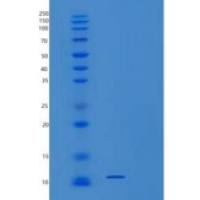 人小泛素相关修饰蛋白3(SUMO3)重组蛋白