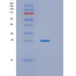 人肿瘤坏死因子α诱导蛋白8(TNFAIP8)重组蛋白
