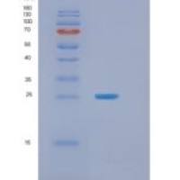 人肿瘤坏死因子α诱导蛋白8(TNFAIP8)重组蛋白