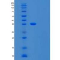 人组织因子通道抑制因子(TFPI)重组蛋白