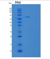人TBC1D22B重组蛋白