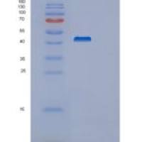 人突触囊泡蛋白Ⅳ(SYT4)重组蛋白