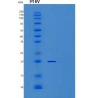 人TMED10重组蛋白