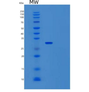 人TGIF2LX重组蛋白