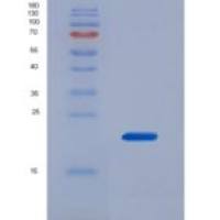大鼠肿瘤坏死因子α(TNFa)重组蛋白