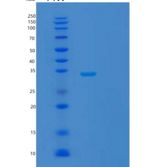 人TBC1域家族成员1(TBC1D1)重组蛋白