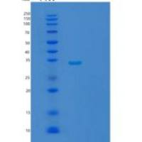 人TBC1域家族成员1(TBC1D1)重组蛋白