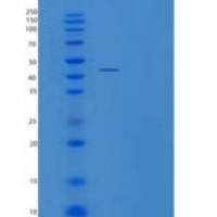 人TNFRSF13B重组蛋白