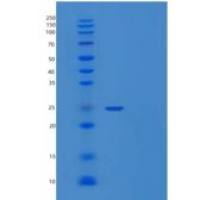 人转胶蛋白3(TAGLN3)重组蛋白