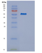 人突触囊泡蛋白Ⅲ(SYT3)重组蛋白