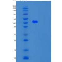 人酪氨酰DNA磷酸二酯酶2(TDP2)重组蛋白