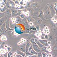 IGR-OV1 人卵巢癌细胞