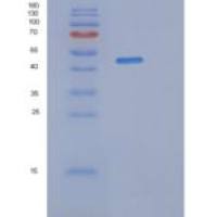 人突触囊泡蛋白XIII(SYT13)重组蛋白